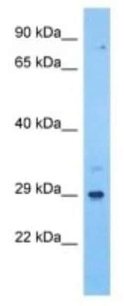 ILT11/LILRA5 Rabbit anti-Human, Polyclonal, Novus Biologicals:Antibodies:Primary